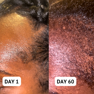 90 DAY CHALLENGE - BALDY TO BADDIE XL